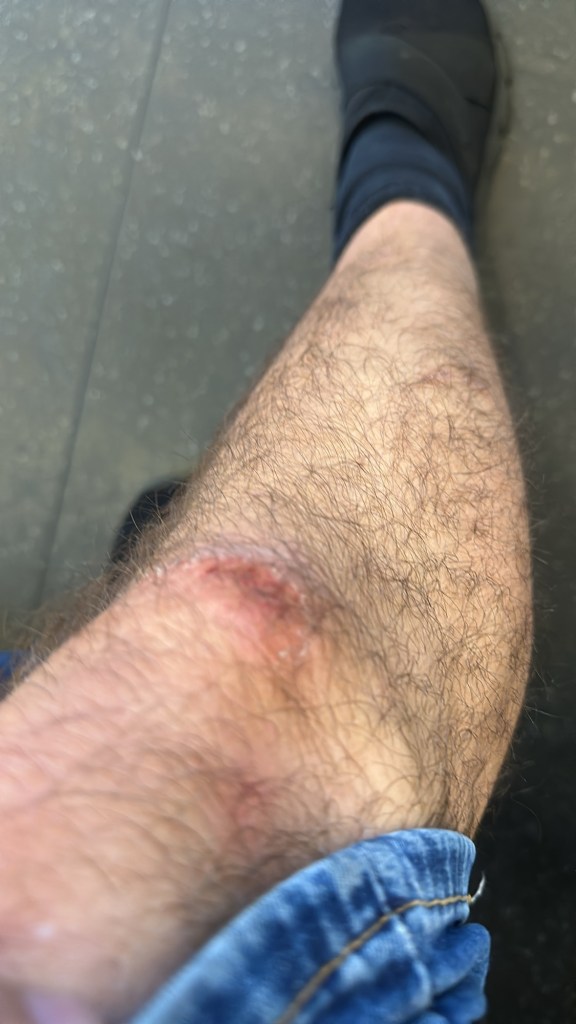 falling and getting 1